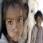 children-are-getting-victim-of-malnutrition-in-nepal